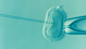 ¿Cómo se Diagnostica la infertilidad Masculina?
